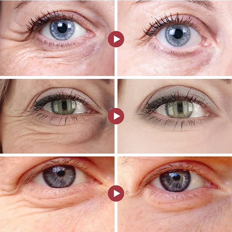 Wrinkle Remove Eyes Patches Fi - Sheet Mask Collagen review and price